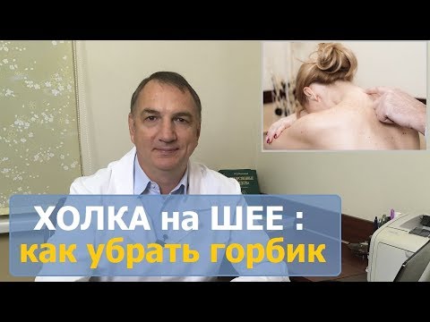 Вдовий горбик, как убрать. Холка, шишка на шее - как избавиться.