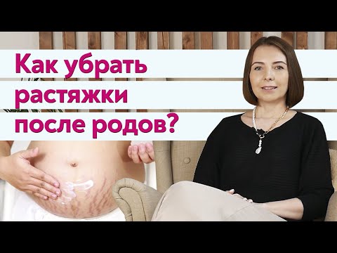 Растяжки на животе! Как избавиться от растяжек после беременности?