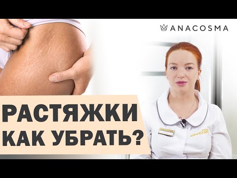 ❗️Как убрать растяжки и стрии?❗️❗️ 👍ТОП-процедур👍