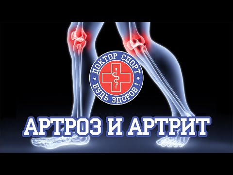 Доктор Спорт «Артроз и Артрит»