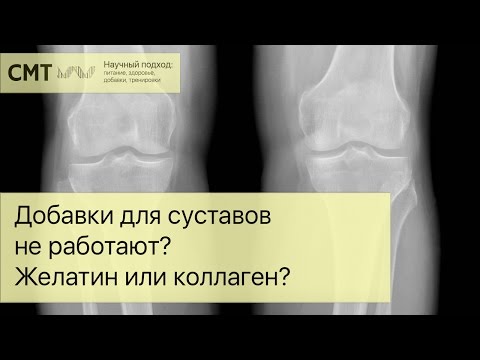 Добавки для суставов НЕ РАБОТАЮТ? Желатин или коллаген?