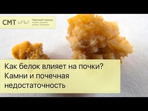 Как белок влияет на почки? Камни и почечная недостаточность