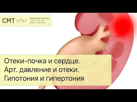 Отеки - почка и сердце. Артериальное давление и отеки. Гипотония и гипертония